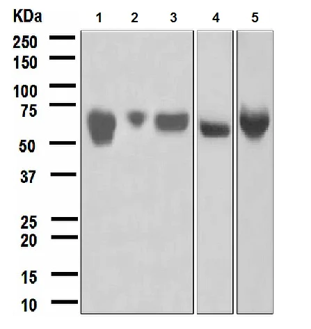 Western blot - Anti-Angiotensinogen antibody [EPR2930(2)] - BSA and Azide free (AB247620)
