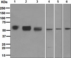 Western blot - Anti-Angiotensinogen antibody [EPR2931] - BSA and Azide free (AB215869), expandable thumbnail