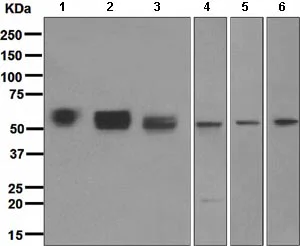 Western blot - Anti-Angiotensinogen antibody [EPR2931] - BSA and Azide free (AB215869)