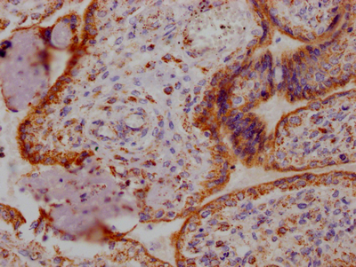 Immunohistochemistry (Formalin/PFA-fixed paraffin-embedded sections) - Anti-ANGPT2 antibody [1F10] (AB302883)