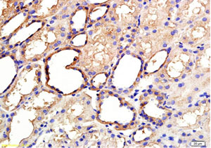 Immunohistochemistry (Formalin/PFA-fixed paraffin-embedded sections) - Anti-ANGPTL3 antibody (AB217865), expandable thumbnail