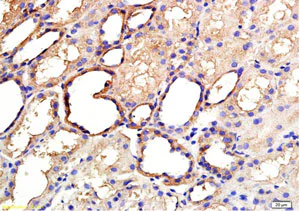 Immunohistochemistry (Formalin/PFA-fixed paraffin-embedded sections) - Anti-ANGPTL3 antibody (AB217865)