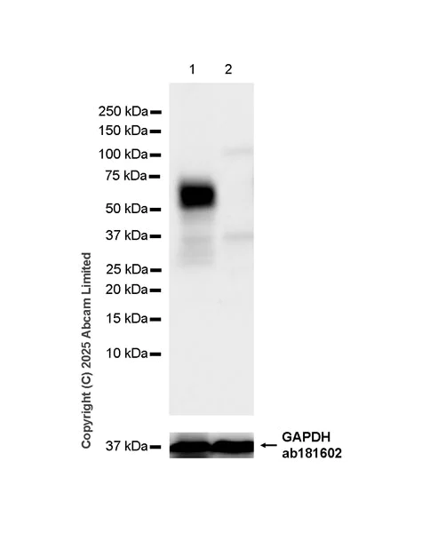 Western blot - Anti-ANGPTL3 antibody [EPR30236-518] (AB324272)