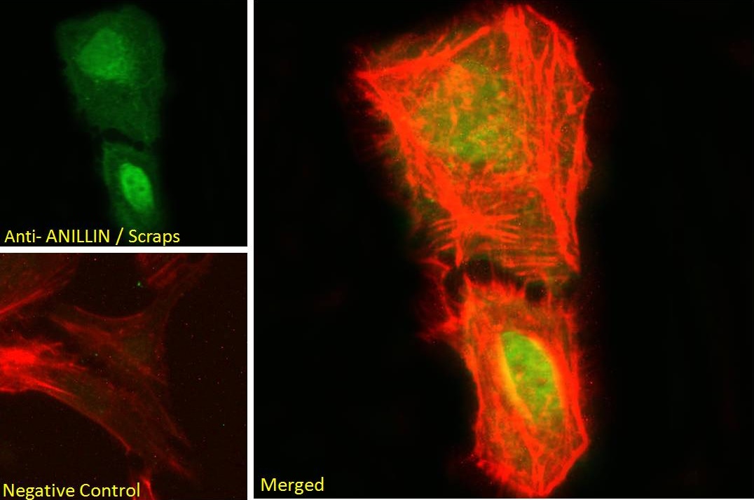 Immunocytochemistry/ Immunofluorescence - Anti-Anillin antibody (AB5910)