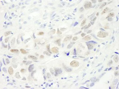Immunohistochemistry (Formalin/PFA-fixed paraffin-embedded sections) - Anti-Anillin antibody (AB84676)