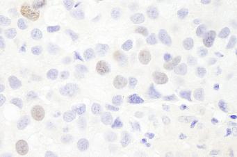 Immunohistochemistry (Formalin/PFA-fixed paraffin-embedded sections) - Anti-Anillin antibody (AB84676)