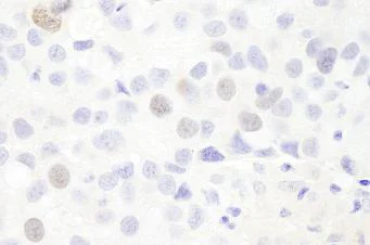 Immunohistochemistry (Formalin/PFA-fixed paraffin-embedded sections) - Anti-Anillin antibody (AB84676)