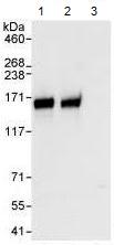 Immunoprecipitation - Anti-Anillin antibody (AB99352), expandable thumbnail