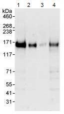 Western blot - Anti-Anillin antibody (AB99352), expandable thumbnail
