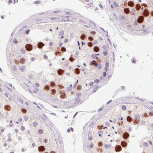 Immunohistochemistry (Formalin/PFA-fixed paraffin-embedded sections) - Anti-Anillin antibody [CL0301] (AB211868)