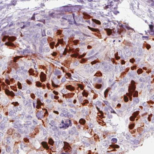 Immunohistochemistry (Formalin/PFA-fixed paraffin-embedded sections) - Anti-Anillin antibody [CL0301] (AB211868)
