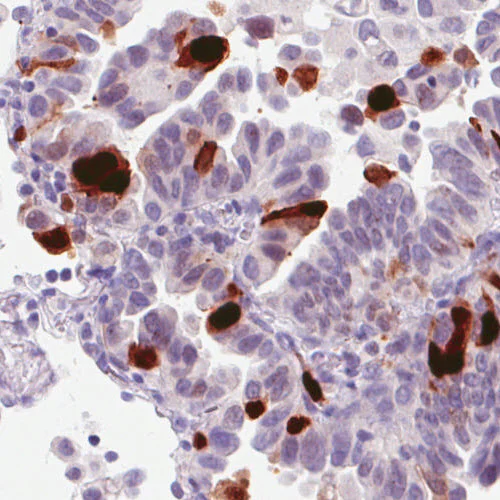 Immunohistochemistry (Formalin/PFA-fixed paraffin-embedded sections) - Anti-Anillin antibody [CL0301] (AB211868)