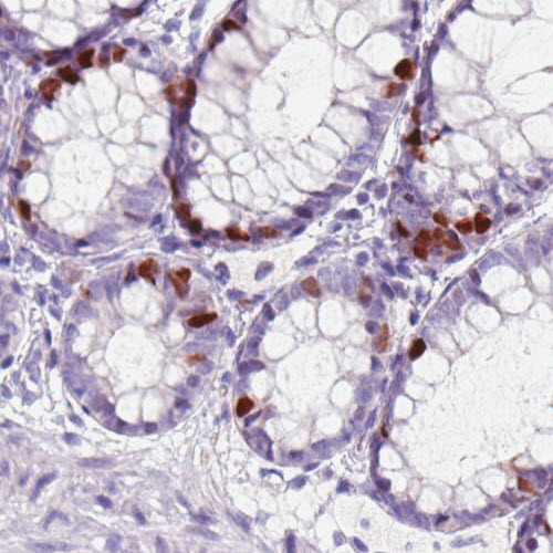 Immunohistochemistry (Formalin/PFA-fixed paraffin-embedded sections) - Anti-Anillin antibody [CL0301] (AB211868)