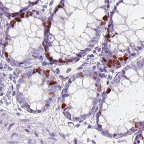 Immunohistochemistry (Formalin/PFA-fixed paraffin-embedded sections) - Anti-Anillin antibody [CL0301] (AB211868)