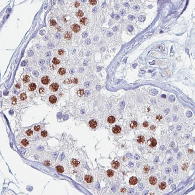Immunohistochemistry (Formalin/PFA-fixed paraffin-embedded sections) - Anti-Anillin antibody [CL0303] (AB211872)