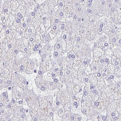 Immunohistochemistry (Formalin/PFA-fixed paraffin-embedded sections) - Anti-Anillin antibody [CL0303] (AB211872)