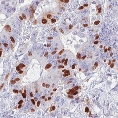 Immunohistochemistry (Formalin/PFA-fixed paraffin-embedded sections) - Anti-Anillin antibody [CL0303] (AB211872)