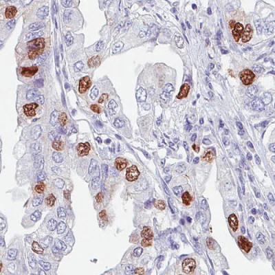 Immunohistochemistry (Formalin/PFA-fixed paraffin-embedded sections) - Anti-Anillin antibody [CL0303] (AB211872)