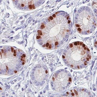 Immunohistochemistry (Formalin/PFA-fixed paraffin-embedded sections) - Anti-Anillin antibody [CL0303] (AB211872)