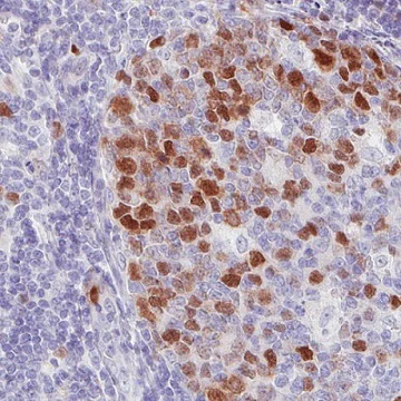 Immunohistochemistry (Formalin/PFA-fixed paraffin-embedded sections) - Anti-Anillin antibody [CL0303] (AB211872)