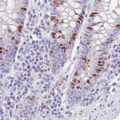 Immunohistochemistry (Formalin/PFA-fixed paraffin-embedded sections) - Anti-Anillin antibody [CL0303] (AB211872)