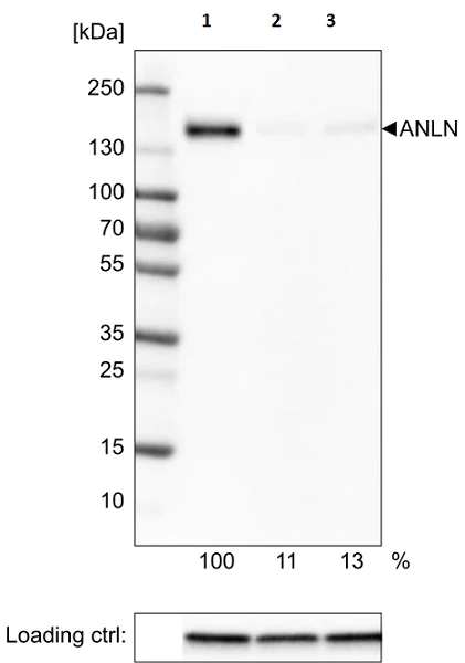 Western blot - Anti-Anillin antibody [CL0303] (AB211872)