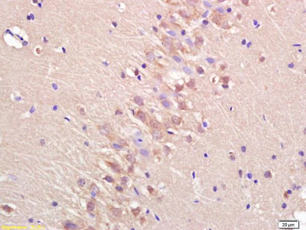 Immunohistochemistry (Formalin/PFA-fixed paraffin-embedded sections) - Anti-ANK-3 antibody (AB213687)