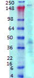 Western blot - Anti-ANK-3 antibody [N106/20] (AB134317)