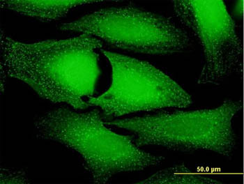 Immunocytochemistry/ Immunofluorescence - Anti-ANKFY1 antibody (AB169273), expandable thumbnail