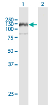 Western blot - Anti-ANKFY1 antibody (AB169273), expandable thumbnail