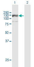 Western blot - Anti-ANKFY1 antibody (AB169273)