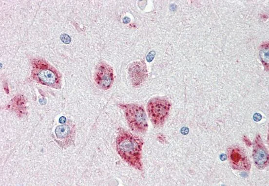 Immunohistochemistry (Formalin/PFA-fixed paraffin-embedded sections) - Anti-ANKH antibody - C-terminal (AB211460)