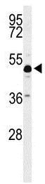 Western blot - Anti-ANKH antibody - C-terminal (AB211460)