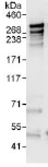 Immunoprecipitation - Anti-ANKHD1 antibody (AB117788)