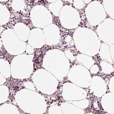 Immunohistochemistry (Formalin/PFA-fixed paraffin-embedded sections) - Anti-ANKLE1 antibody (AB222029)