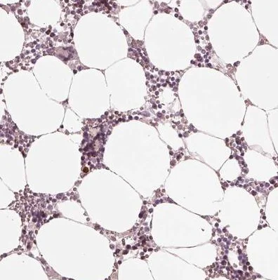 Immunohistochemistry (Formalin/PFA-fixed paraffin-embedded sections) - Anti-ANKLE1 antibody (AB222029)