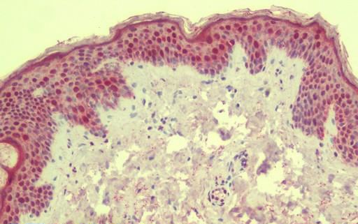 Immunohistochemistry (Formalin/PFA-fixed paraffin-embedded sections) - Anti-ANKLE1 antibody - C-terminal (AB189990)
