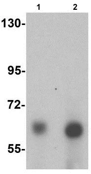 Western blot - Anti-ANKLE1 antibody - C-terminal (AB189990)