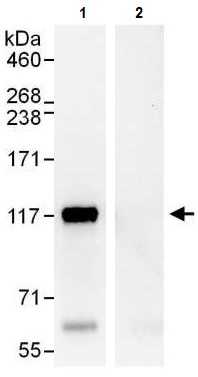 Immunoprecipitation - Anti-ANKLE2 antibody (AB225905), expandable thumbnail