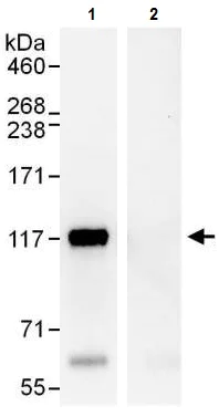 Immunoprecipitation - Anti-ANKLE2 antibody (AB225905)