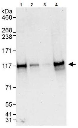 Western blot - Anti-ANKLE2 antibody (AB225905), expandable thumbnail