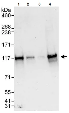 Western blot - Anti-ANKLE2 antibody (AB225905)
