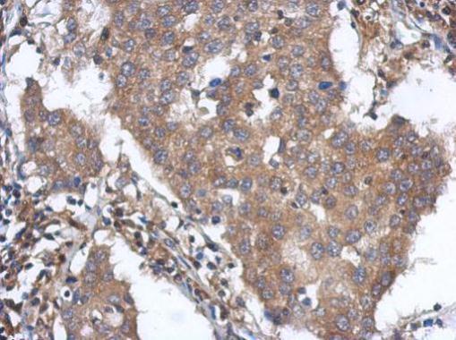 Immunohistochemistry (Formalin/PFA-fixed paraffin-embedded sections) - Anti-ANKLE2 antibody (AB227538)