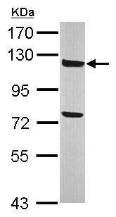 Western blot - Anti-ANKLE2 antibody (AB227538)
