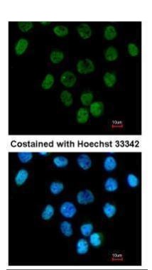 Immunocytochemistry/ Immunofluorescence - Anti-ANKRD1 antibody (AB272894)