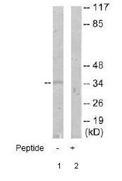 Western blot - Anti-ANKRD1 antibody (AB64963), expandable thumbnail