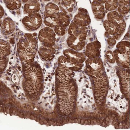 Immunohistochemistry (Formalin/PFA-fixed paraffin-embedded sections) - Anti-ANKRD10 antibody (AB204396)