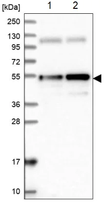 Western blot - Anti-ANKRD10 antibody (AB204396)