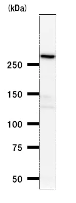 Western blot - Anti-ANKRD11 antibody [2022C8a] (AB50852)