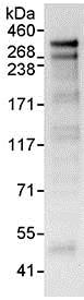 Immunoprecipitation - Anti-ANKRD17 antibody (AB85726)
